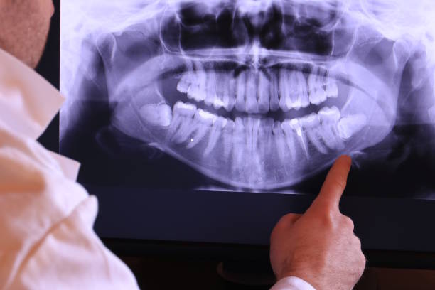 Best Emergency Tooth Extraction in Greenland, AR